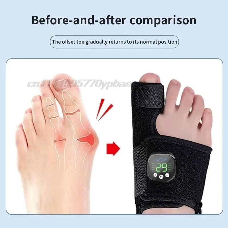 Gamma™ Electric Bunion Corrector