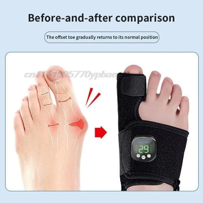 Gamma™ Electric Bunion Corrector